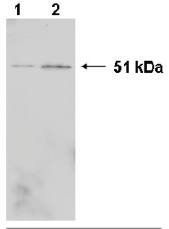 Mouse anti Human Heterogeneous Nuclear Ribonucleoprotein K