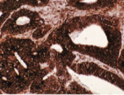 Mouse anti Human T-Complex Protein 1, subunit