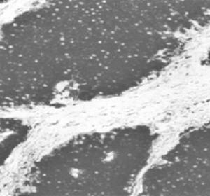 Mouse anti Human Enolase