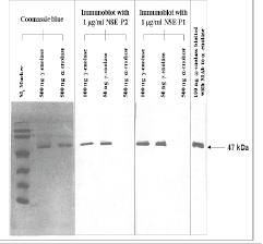 Mouse anti Human Enolase