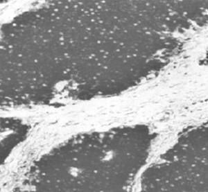 Mouse anti Human Neuron-Specific Enolase