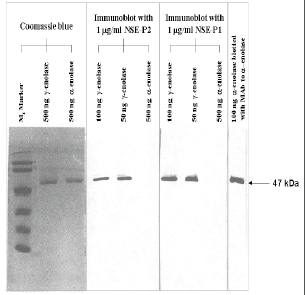 Mouse anti Human Neuron-Specific Enolase