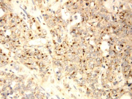 XIAP-associated factor 1 XAF1 Antibody
