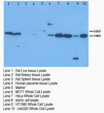 XIAP-associated factor 1 XAF1 Antibody
