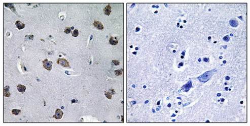 MIPT3 Antibody