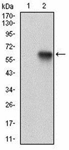 XRCC6