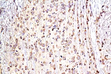 Tau antibody