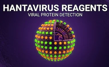 Hantavirus Antibodies & Kits