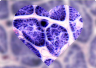 Cardiac Markers